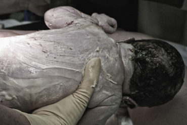 Käseschmiere auf einem Neugeborenem. Foto: Wikimedia/Llapissera