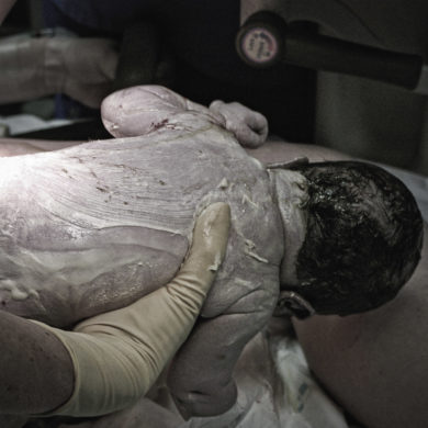 Käseschmiere auf einem Neugeborenem. Foto: Wikimedia/Llapissera